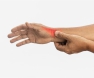 Dequervain’s Tenosynovitis