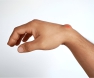Ganglion Cysts