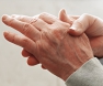 Rheumatoid Arthritis