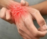 Wrist Sprain